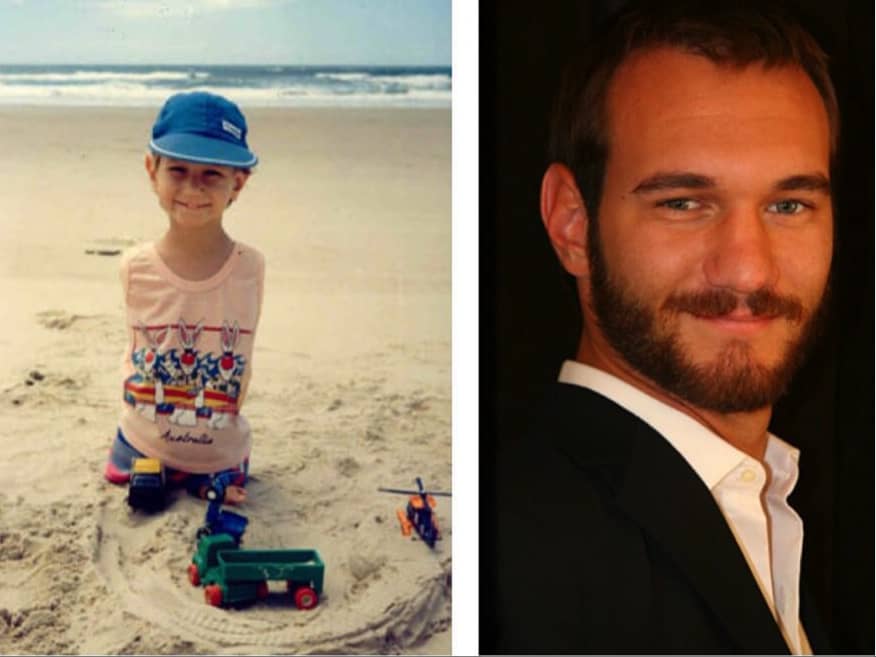 Foto y biografía de Nick Vujicic