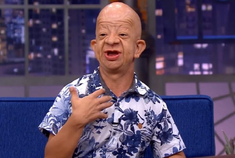 bruno-diferente-imagee